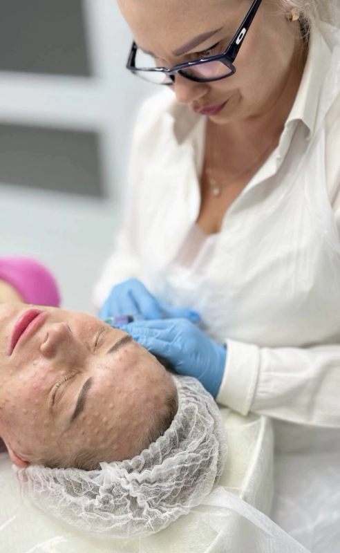 Skin Rejuvenation Hounslow